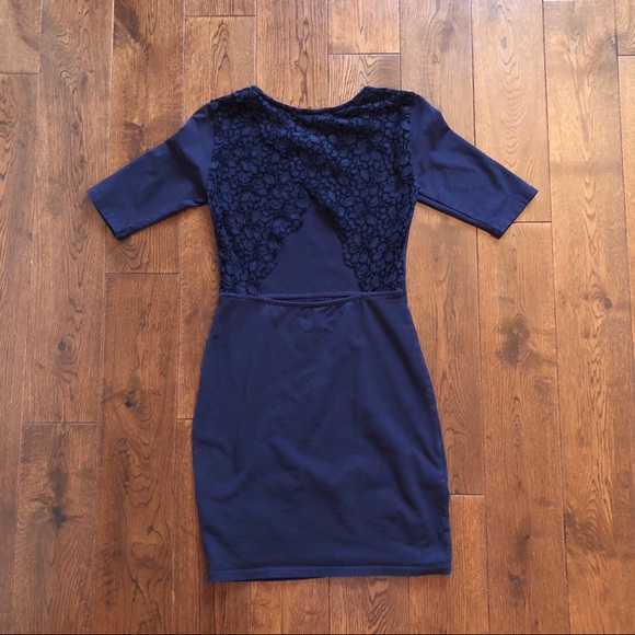 Aritzia Talula lace open back dress - Picture 3 of 4